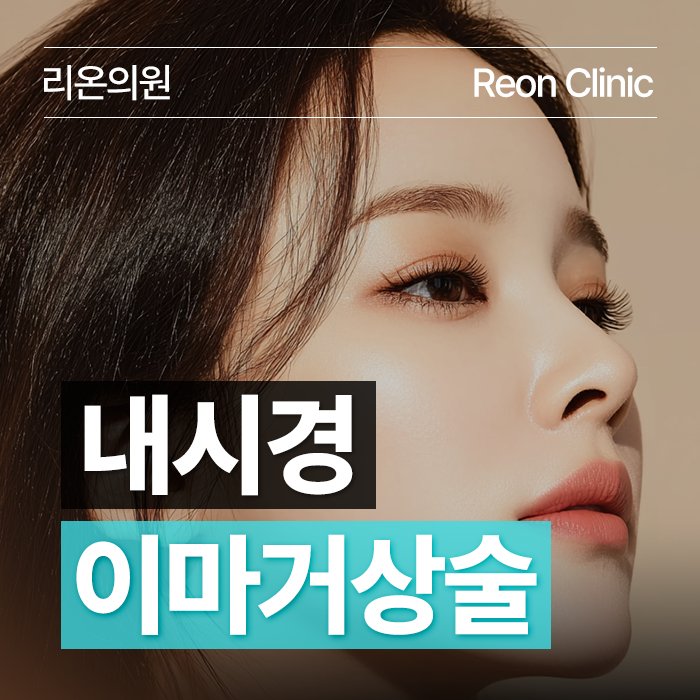 부산 대연동 내시경이마거상술